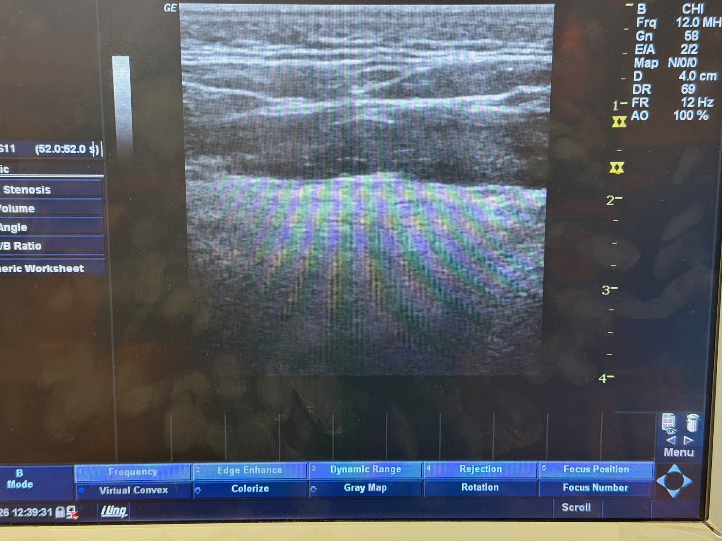 GE Ultrasound Probe - 12L Probe – TESTED